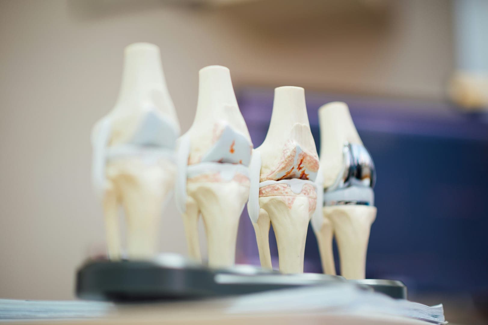 Advanced Fracture & Plaster Techniques
